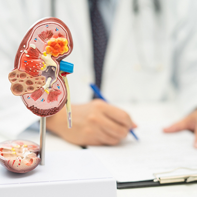 is kidney disease always hereditary?